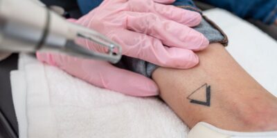 Entscheidungen, die unter die Haut gehen – und wieder verschwinden dürfen